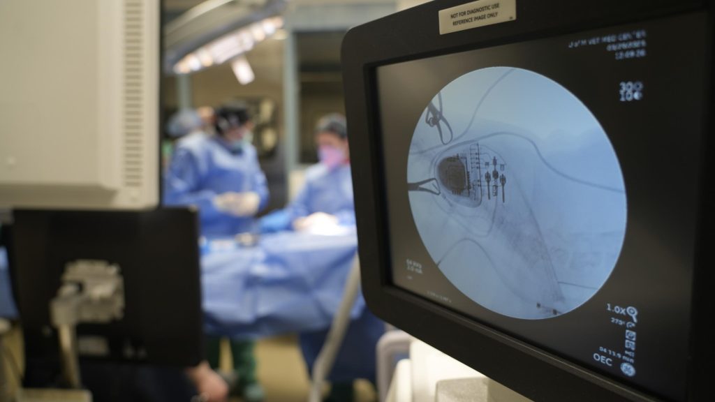 Pacemaker Evaluation